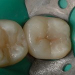 intarsio3